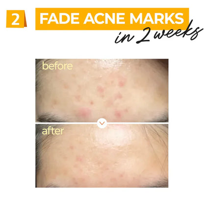 Numbuzin No.5 Vitamin Concentrated Serum 30ml